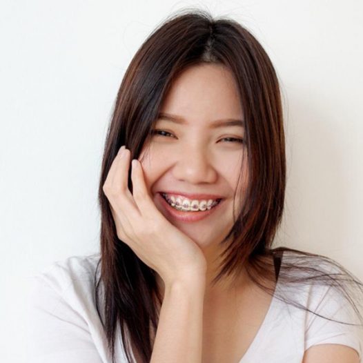 Want to Straighten Teeth without Braces: Invisalign Can Help You Achieve Your Goal